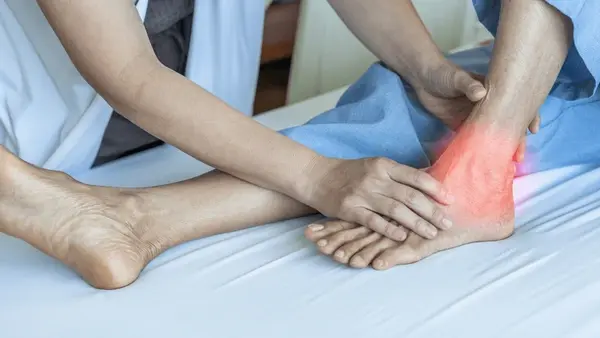 ankle sprain treatment near you