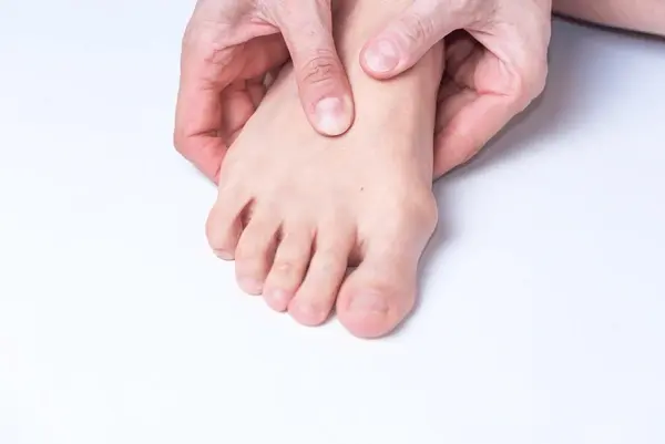bunion treatment