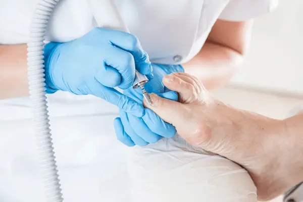 fungal nail treatment