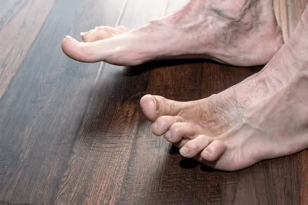 hammertoe treatment near you
