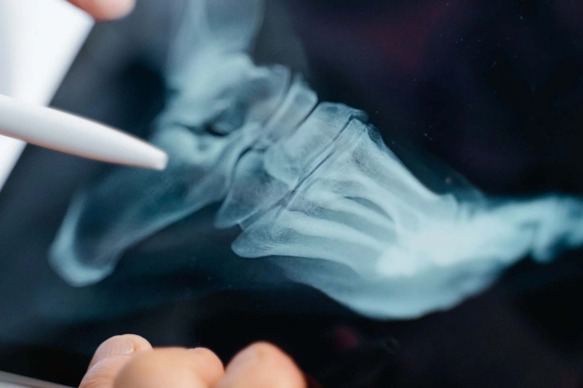 expert foot and ankle solutions from a podiatrist near you