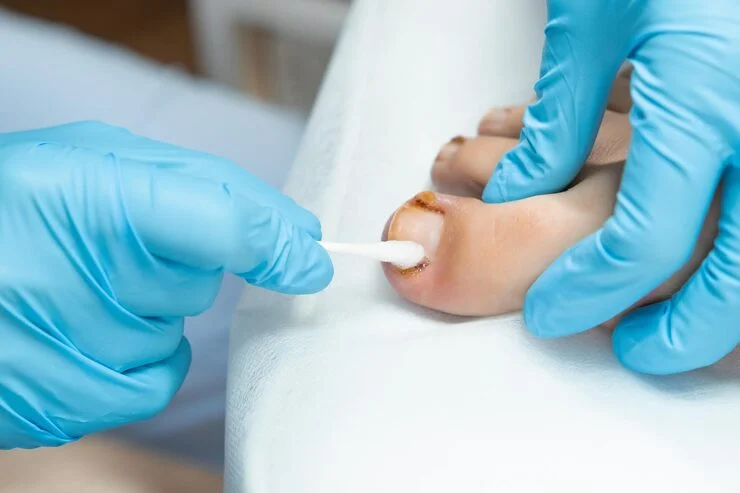 podiatrist near agoura hills, ca